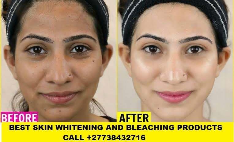 Permanent Skin Lightening Skin Whitening Products 